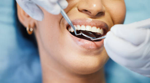 Best Knocked-Out Tooth Emergency  in Woodmoor, CO