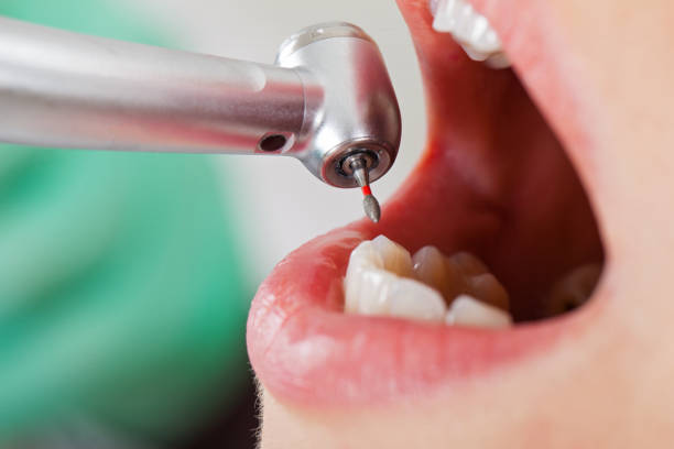 Best Emergency Dental Filling Replacement  in Woodmoor, CO
